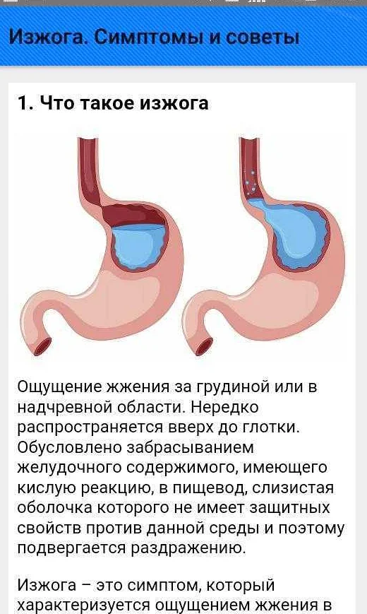 Дискомфорт при беременности – отрыжка