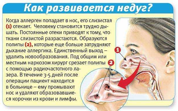 Почему у ребенка неприятно пахнет из носа и что делать в этой ситуации?