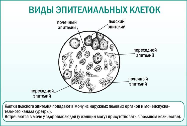 Эпителий в моче: плоский, почечный, переходный