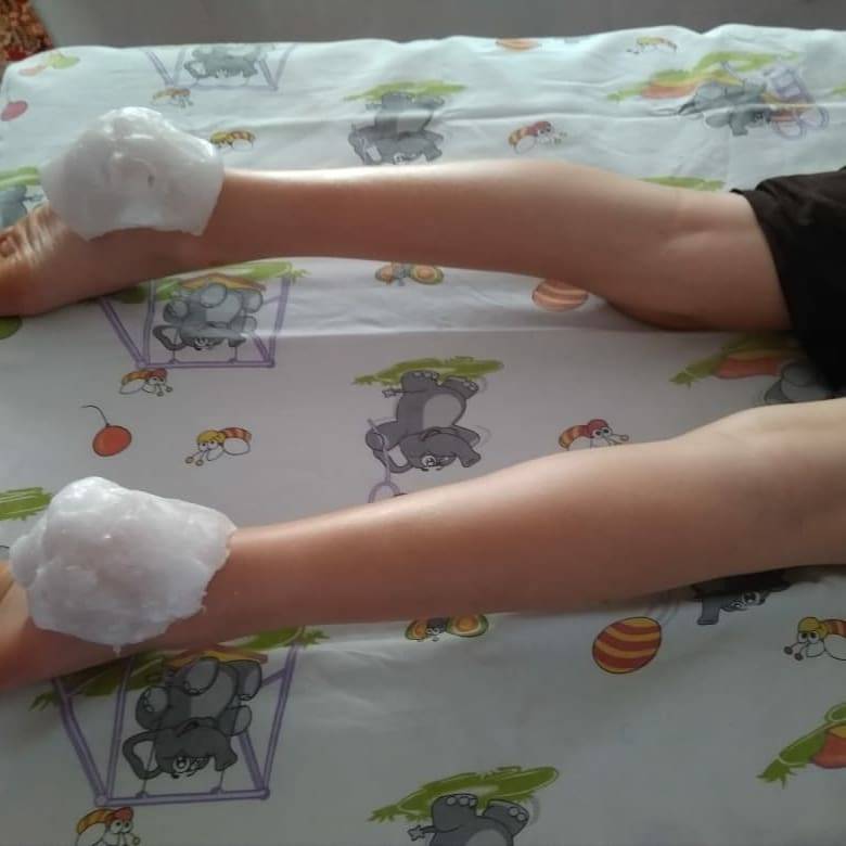 Парафиновый компресс в домашних условиях. парафинотерапия: общие правила и рецепты