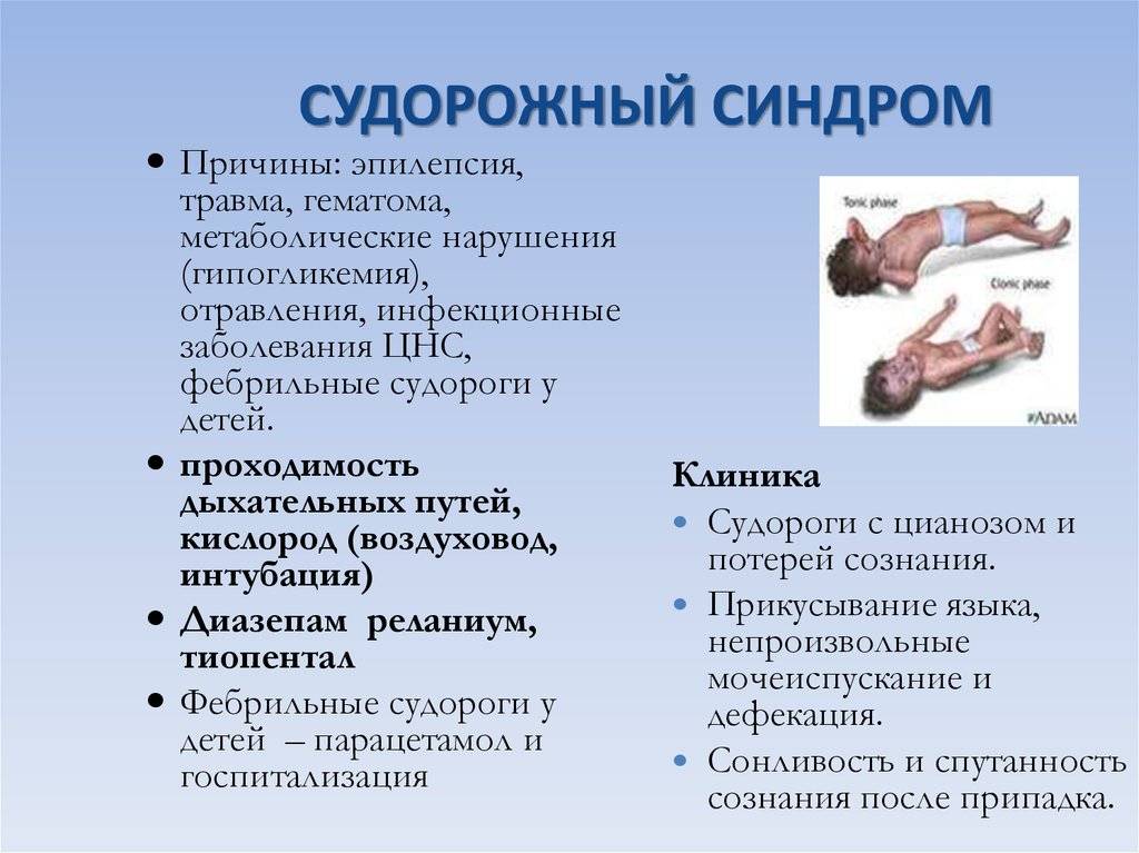 Признаки эпилепсии у детей до года: симптомы, причины, как лечить грудничков