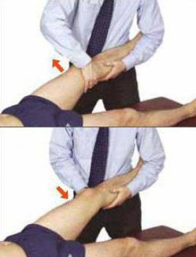 Вальгусная деформация коленных суставов: лечение, массаж | мрикрнц.рф