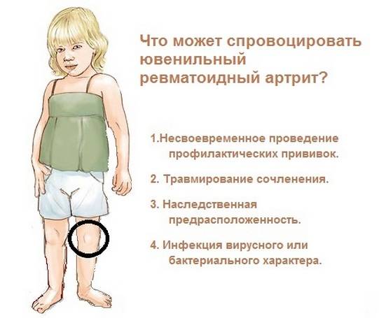 Реактивный артрит коленного сустава у детей