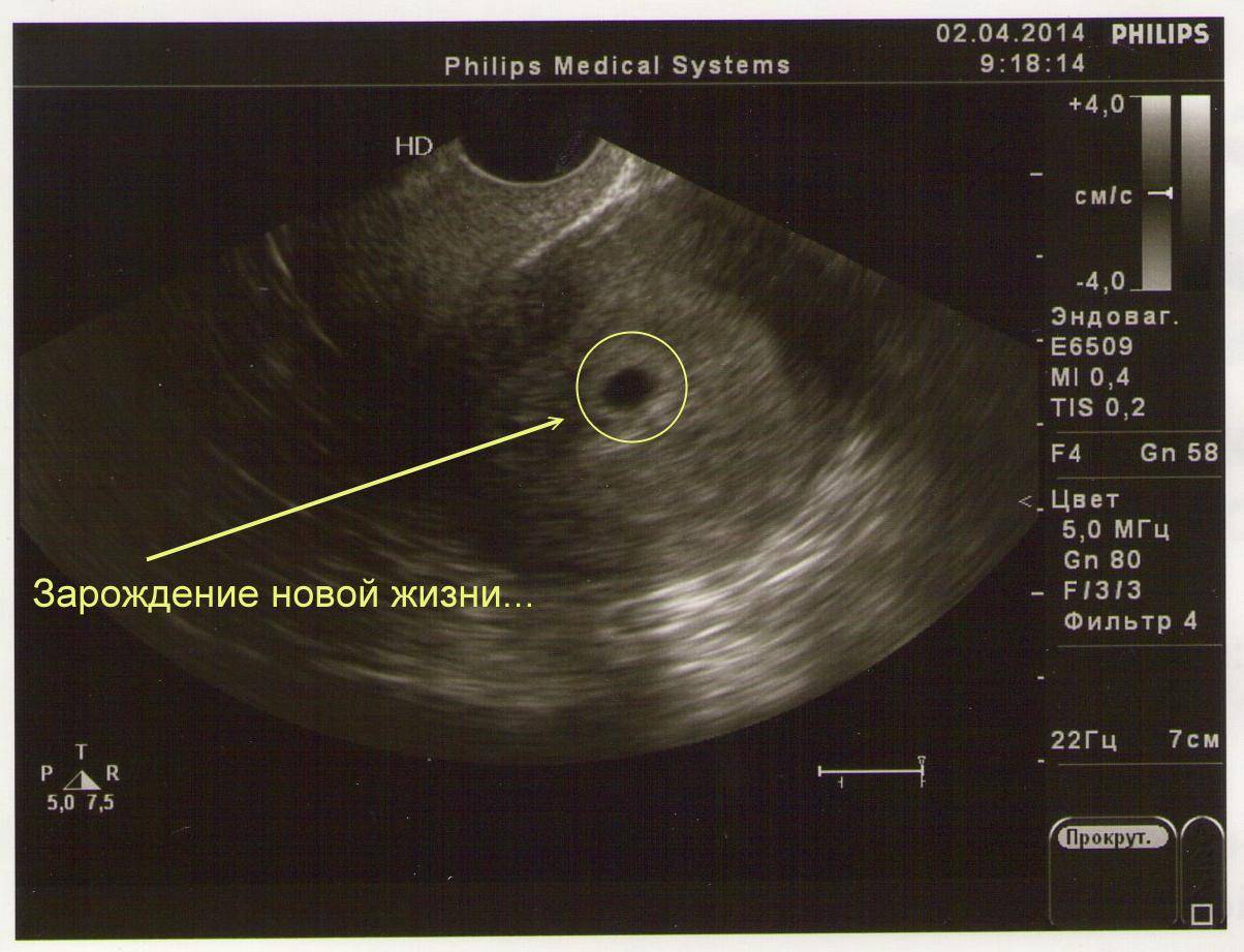 Беременность 4 недели видна на узи