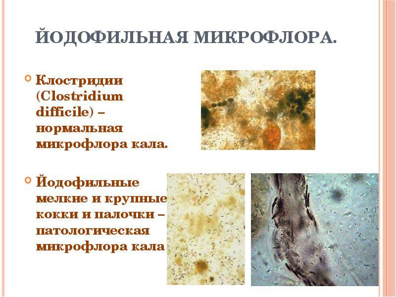 Йодофильные бактерии в кале у ребенка: о чем говорит копрограмма