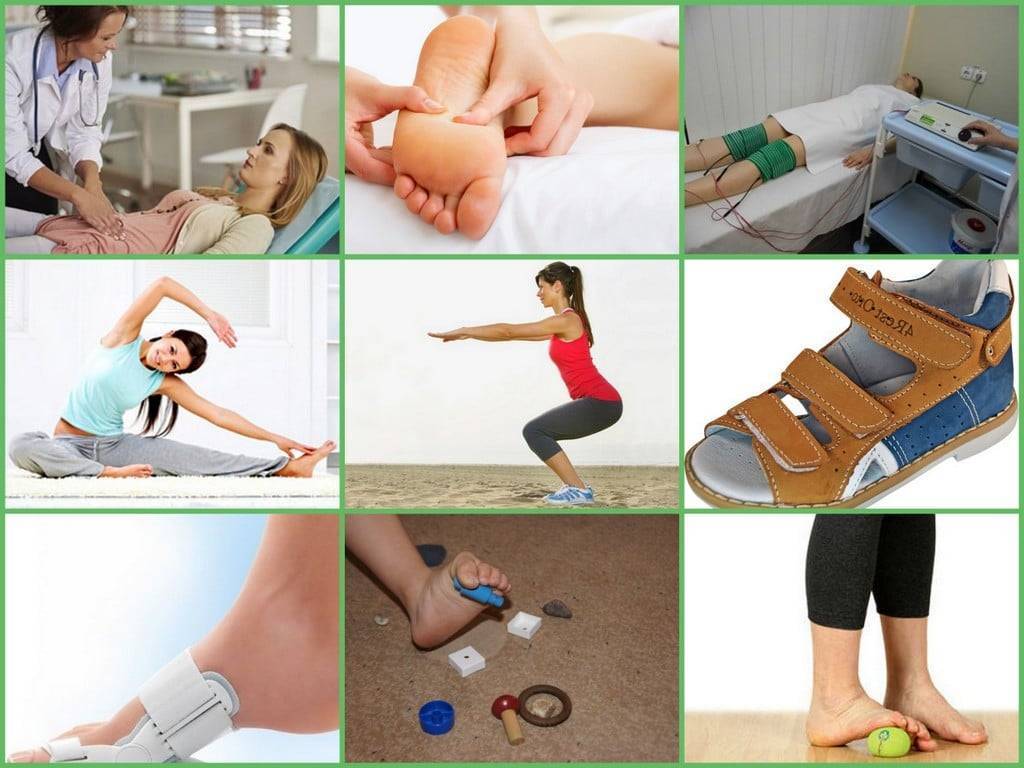 Коррекция вальгусной деформации коленных суставов у детей: признаки на фото, причины, лечение и профилактика