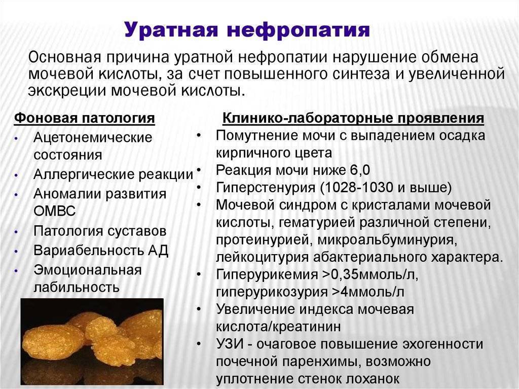 Соли в моче у ребенка: причины, лечение, профилактика