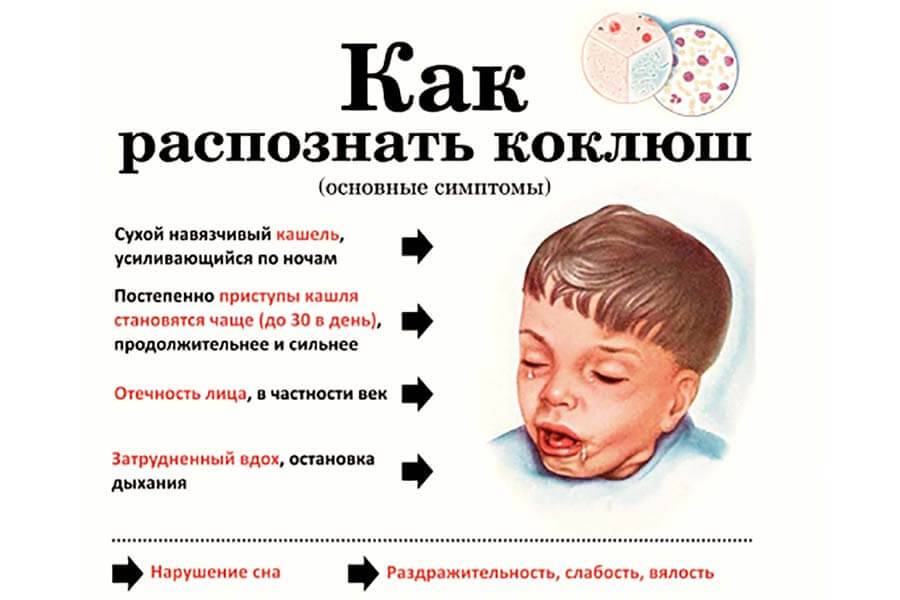 После прививки акдс появился насморк кашель