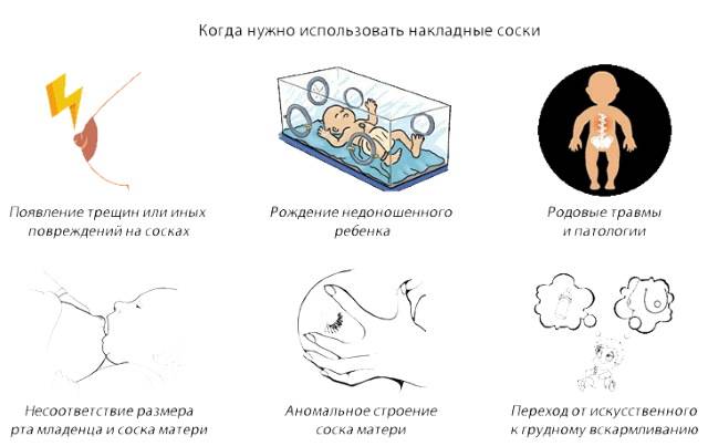 Накладки для грудного вскармливания: как подобрать | s-voi.ru