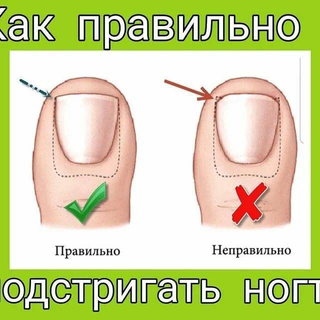 Когда можно начать стричь ногти младенцу, и как это делать правильно? ~