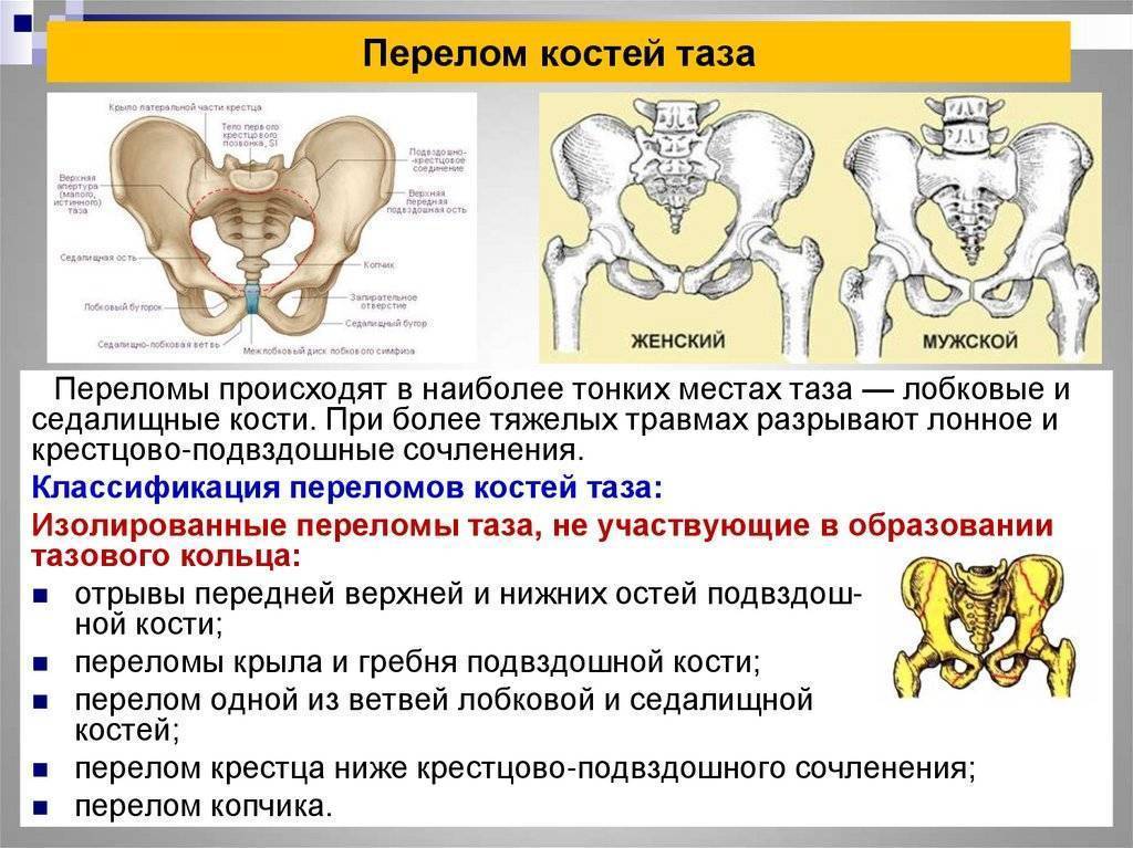 Расхождение костей таза при беременности: когда начинается, причины и лечение — когда начинают расходиться кости таза при беременности — центр гинекологии и акушерства
