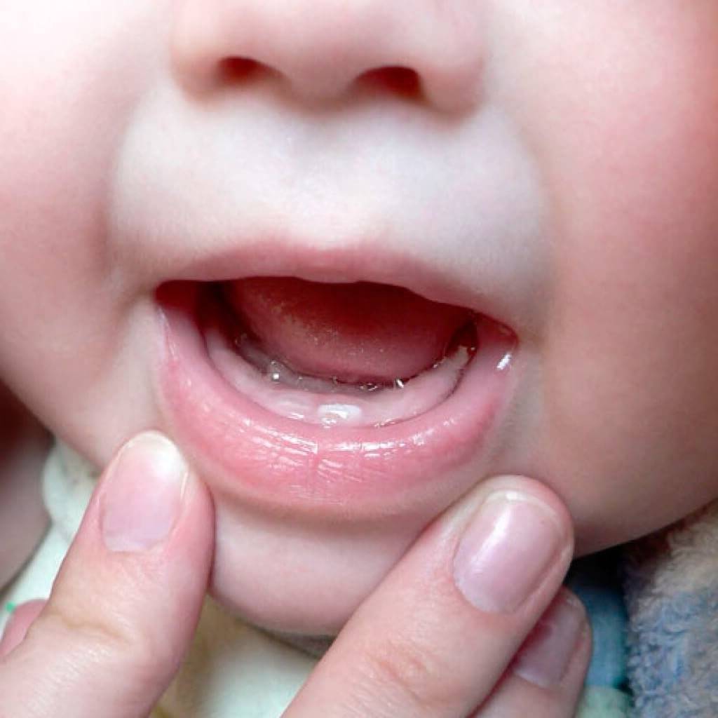 Прорезывание зубов у детей | уроки для мам