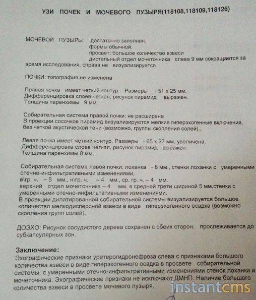 Узи почек ребенку, исследование мочевого пузыря: подготовка к процедуре и порядок ее проведения