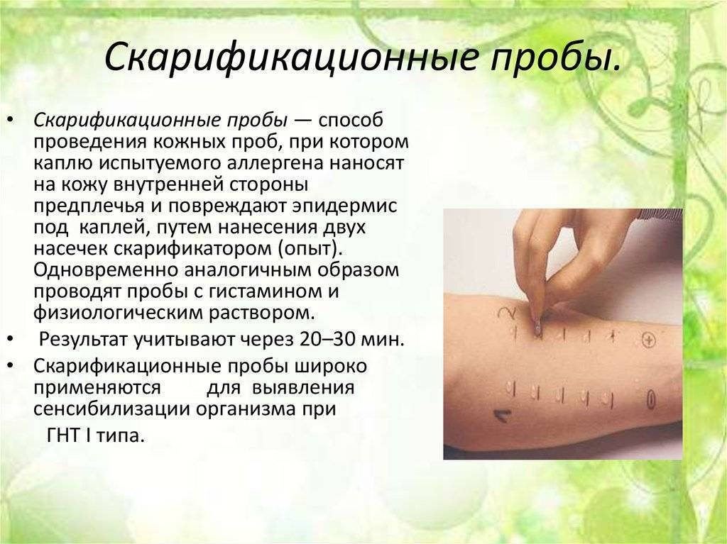 Анализ на аллергены у ребенка: сдача крови, кожные пробы, провокационный тест при аллергии