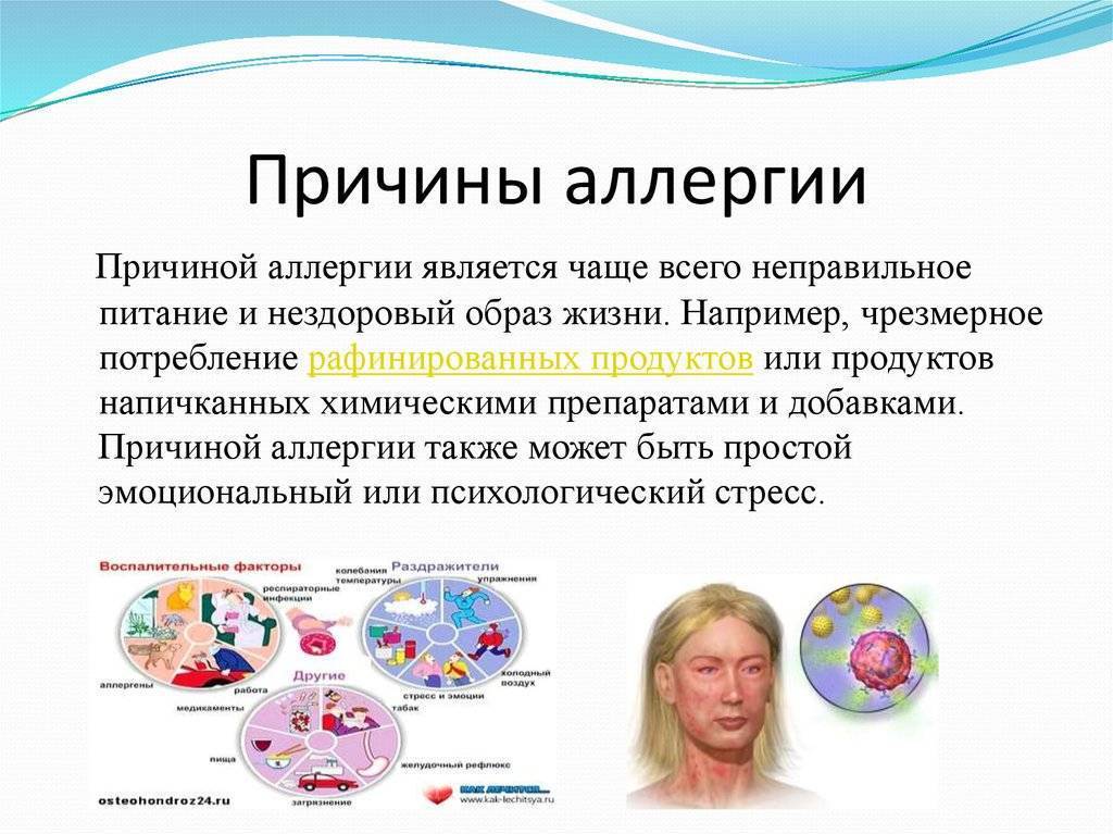 Аллергические высыпания на коже у ребенка: как выглядит сыпь при аллергии