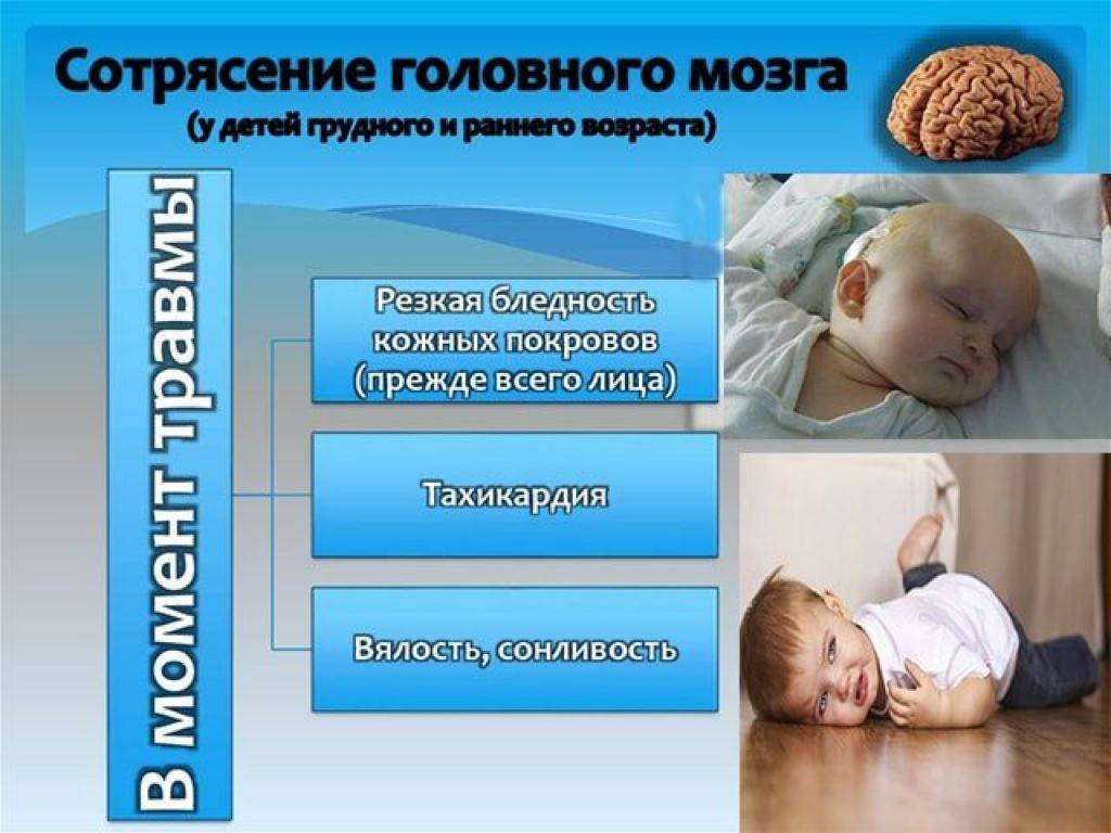 Сотрясение мозга у ребенка: симптомы и лечение в домашних условиях