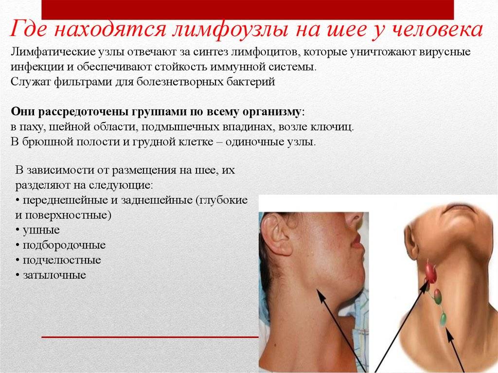Лимфоузлы на шее у ребенка: что делать при симптомах, профилактика воспаления