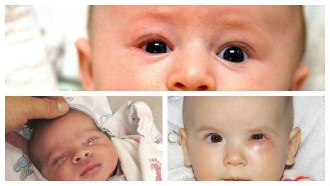 Чем промывать глаза новорожденному | уроки для мам
