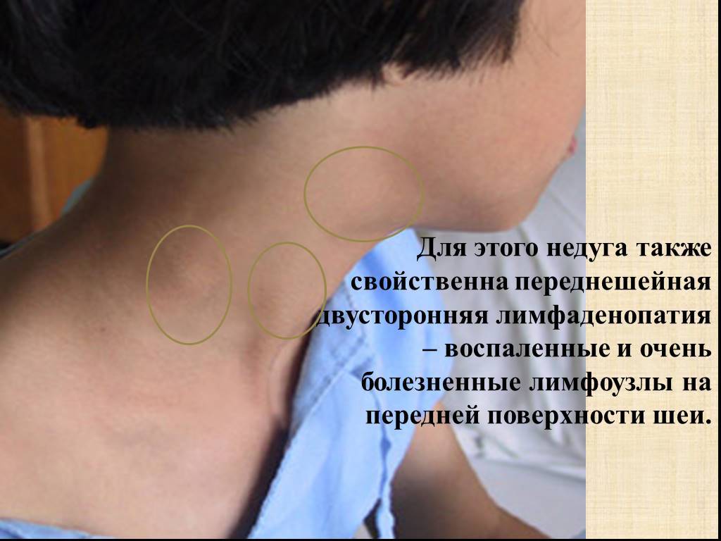 Шарик (шишка) на шее под кожей: топ методов лечения