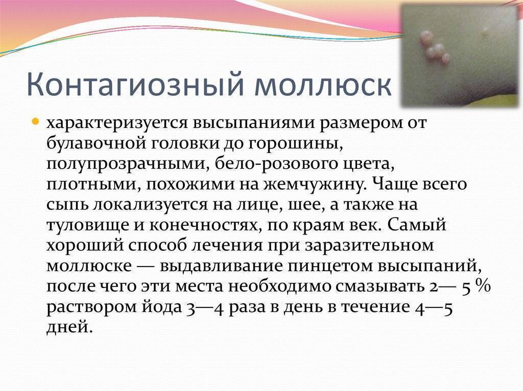 Контагиозный моллюск у детей: фото, причины и лечение, профилактика