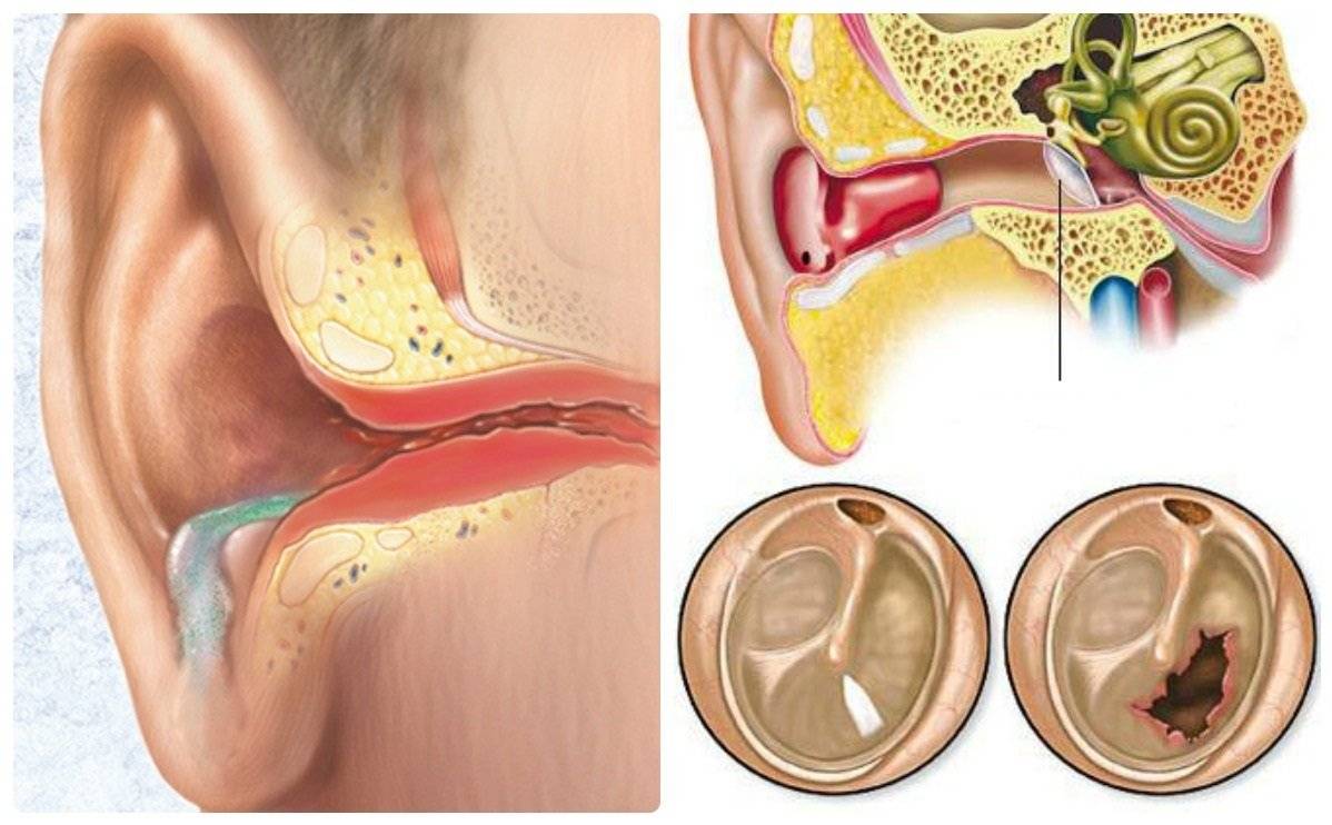Причины запаха из ушей у грудничка