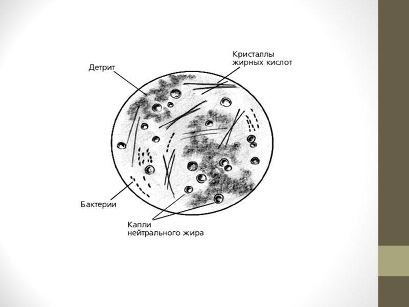 Спермограмма как метод диагностики мужского бесплодия