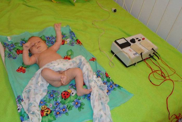 Электрофорез с эуфиллином на шейный отдел грудничку | ru-babyhealth