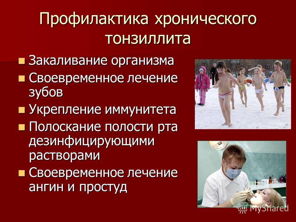 Ангина (острый тонзиллит) у детей: виды, симптомы и как лечить