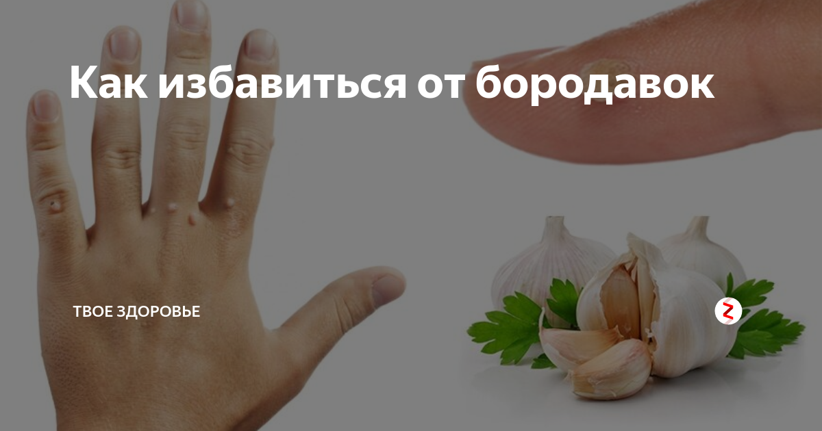 Чем лучше лечить подошвенную бородавку у ребенка: фото, лечение и удаление