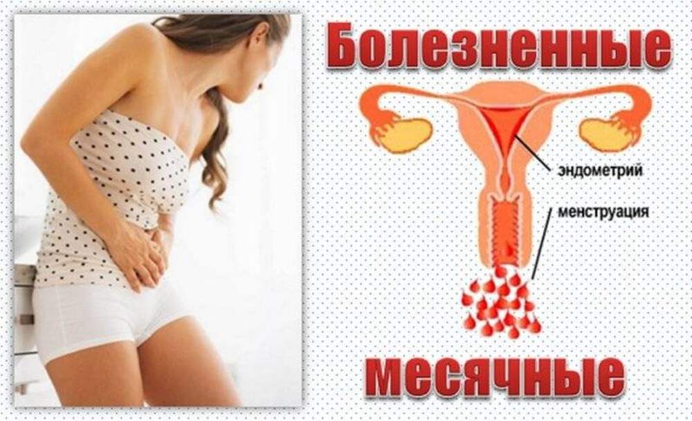 Боли при менструации