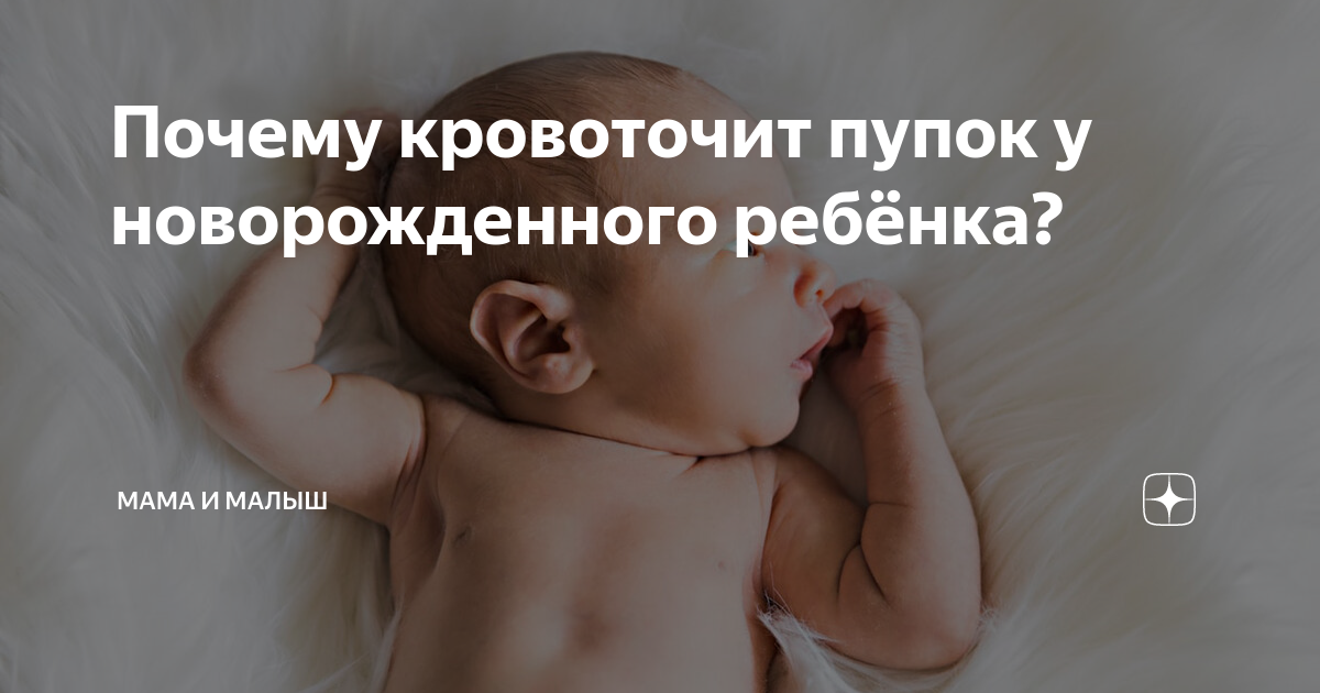 Если кровит пупок у новорождённого что делать, какие меры предпринять