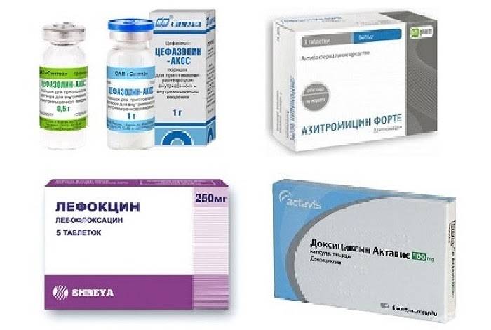 Нужно ли пить антибиотики и какие именно для лечения бронхита у ребенка