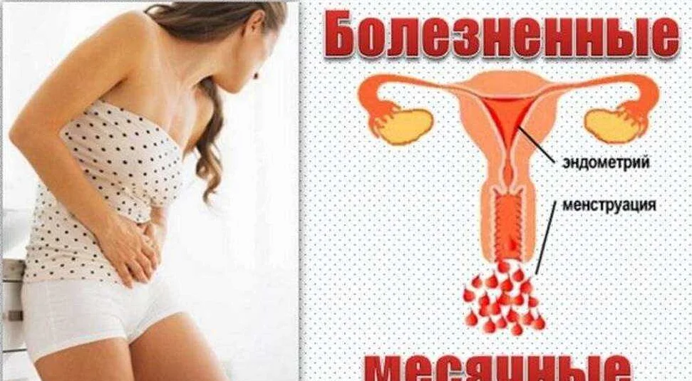 Симптомы боли в матке у женщин: причины и как облегчить состояние