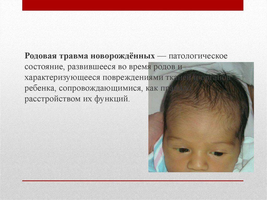 Родовая травма шейного отдела позвоночника последствия