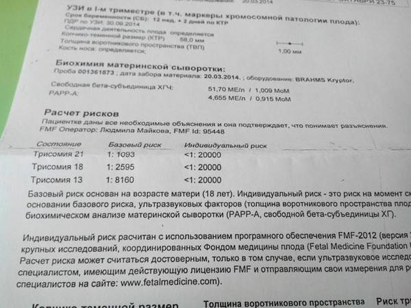 Расширенное воротниковое пространство у плода