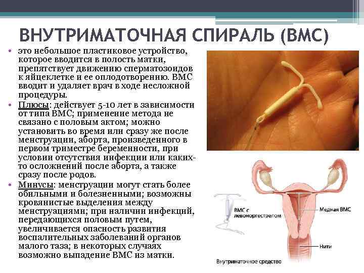 Внутриматочная спираль после родов - когда и кому ставить