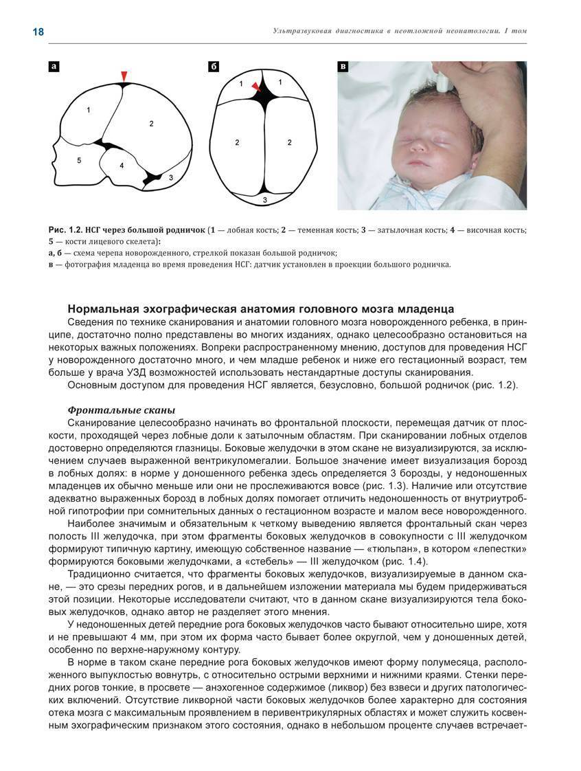 Расширенные желудочки головного мозга у ребенка и их последствия | плюсы и минусы