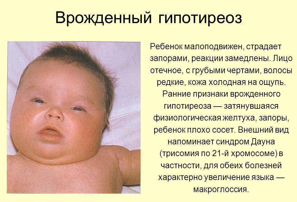 Токсическая эритема новорожденных: симптомы и лечение. что такое эритема новорожденных?