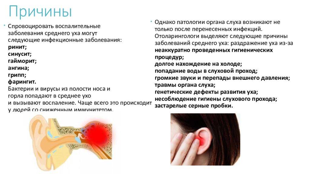 Кровотечения из ушей: причины, как лечить