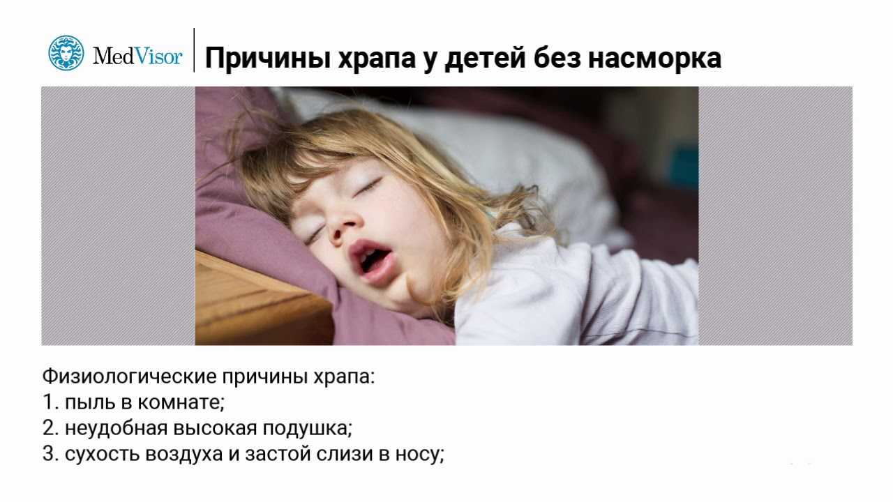 Почему ребенок храпит во сне и как избавиться от этого?