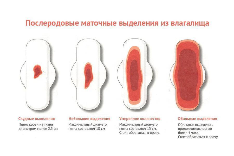 Выделения у женщин из влагалища: какие должны быть нормальные, патологические выделения (фото, картинки)