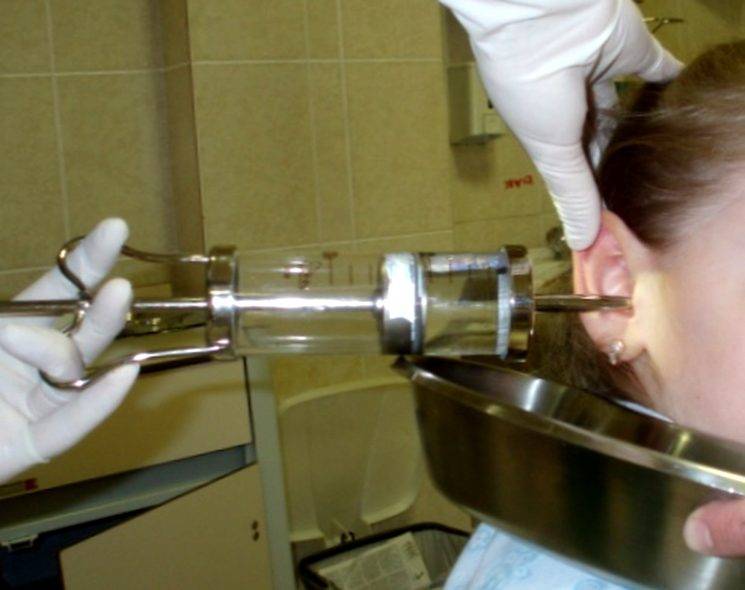 Как правильно и чем чистить уши ребенку?