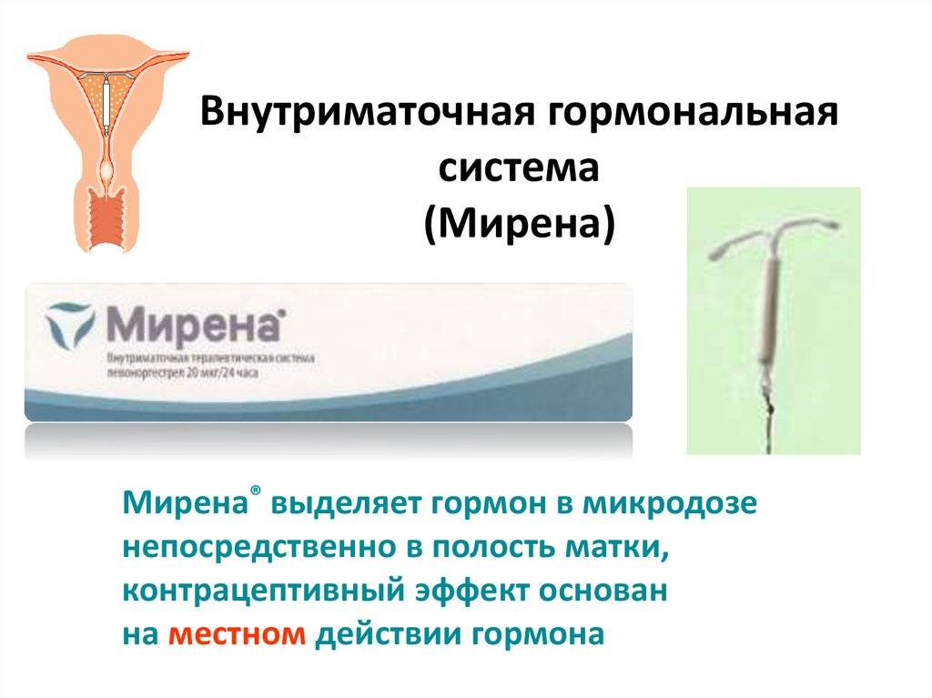 Что будет если спираль стоит больше срока? - quepaw
