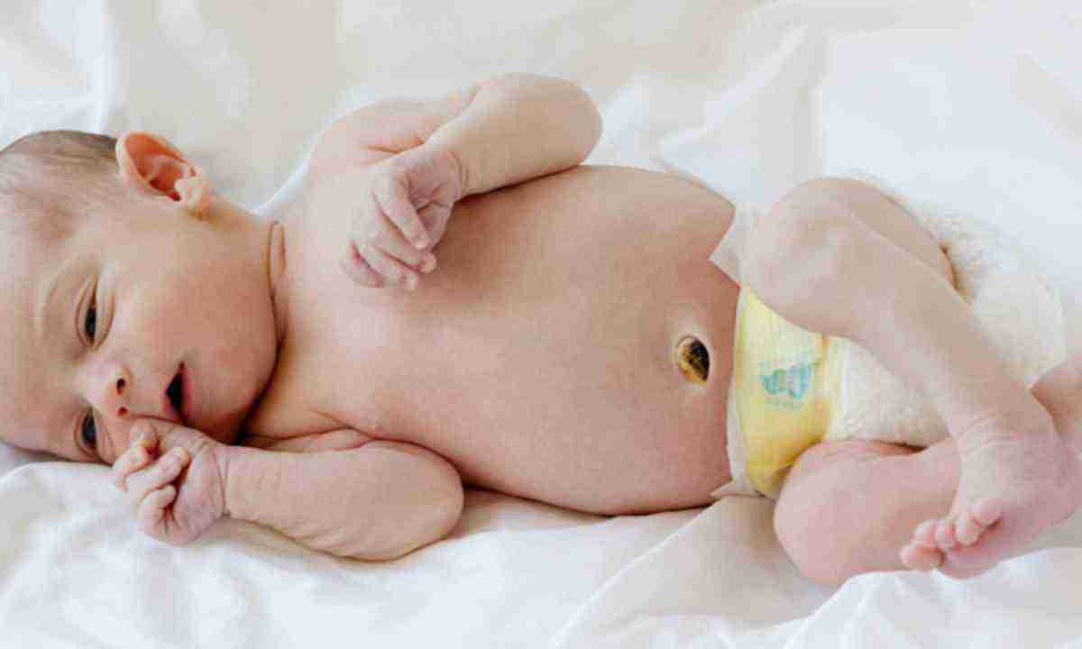 Фунгус пупка у новорожденных: причины и последствия, симптомы с фото и лечение, мнение комаровского