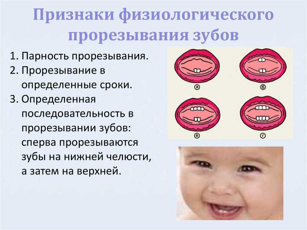 Насморк при прорезывании зубов - что делать, если на зубы сопли?