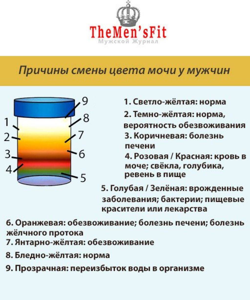 Бесцветная моча у ребенка: прозрачная, желтая, белая - что это значит и почему меняется цвет?