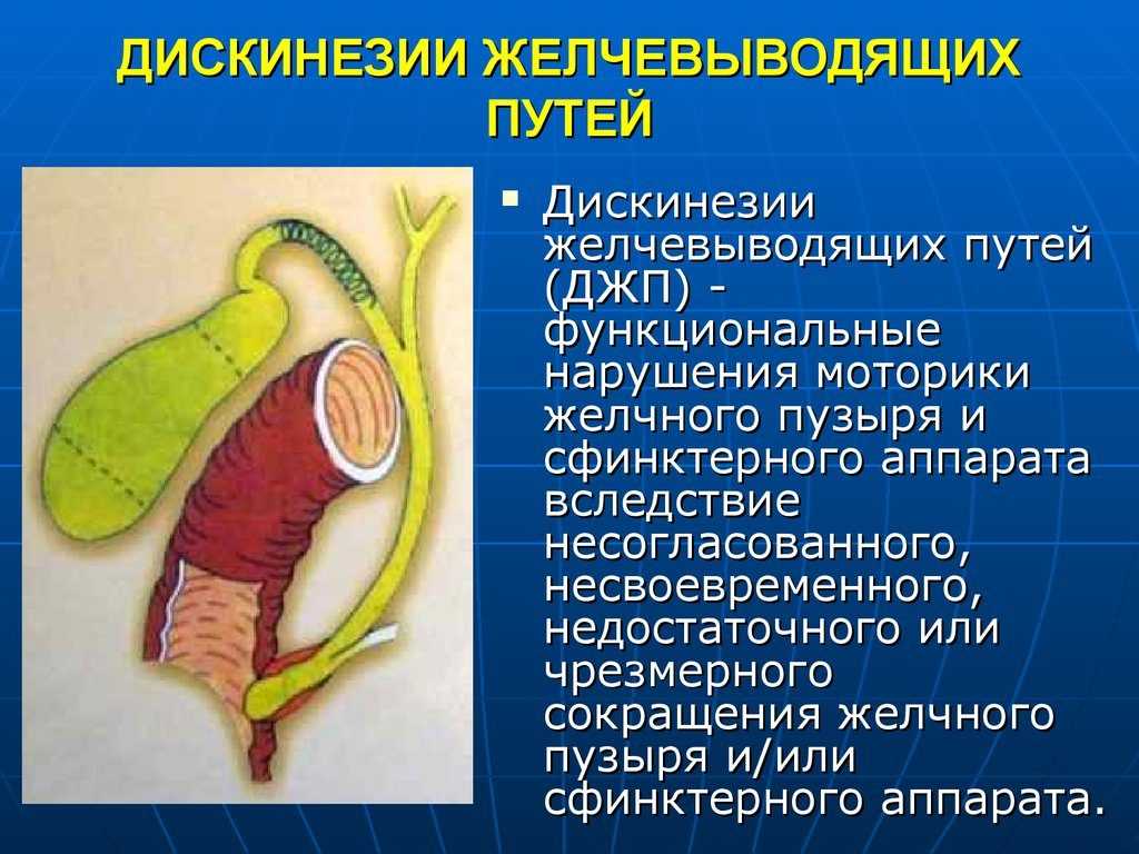 Дискинезия желчевыводящих путей у детей