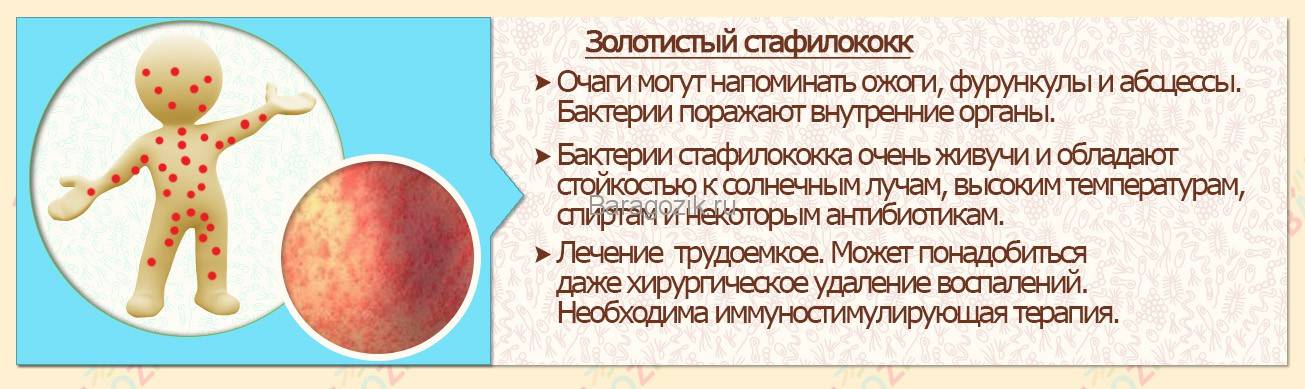 Грибковые инфекции у детей: симптомы, лечение и профилактика