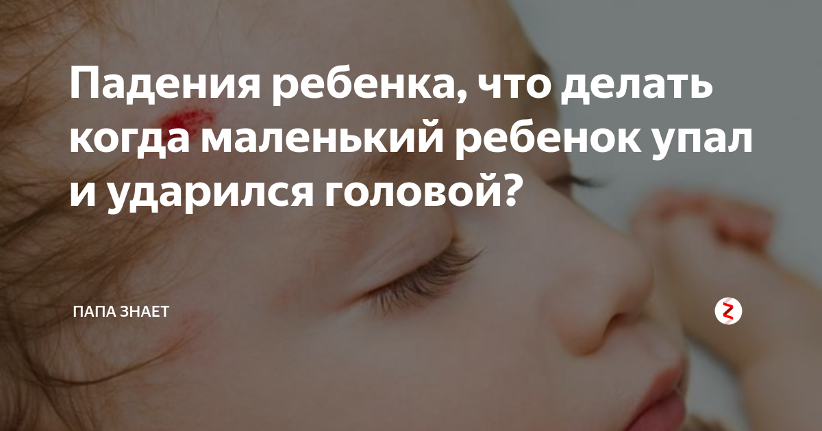 Ребенок упал с дивана вниз головой - комаровский рассказывает, что делать при падении с кровати