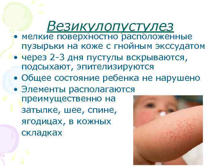 Шелушится кожа на теле у новорожденного: что делать, уход когда облазит
